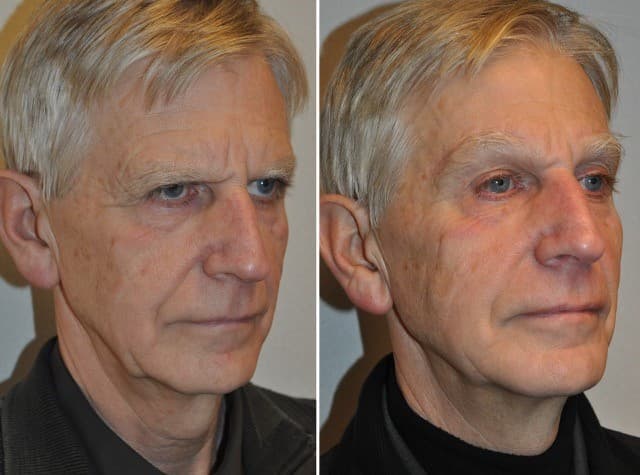 Resultaat foto 3